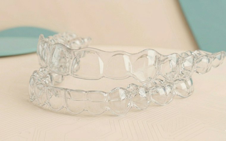 Aligneurs transparents sur mesure